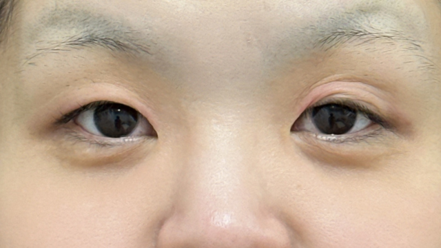 Postoperative Condition Part 1