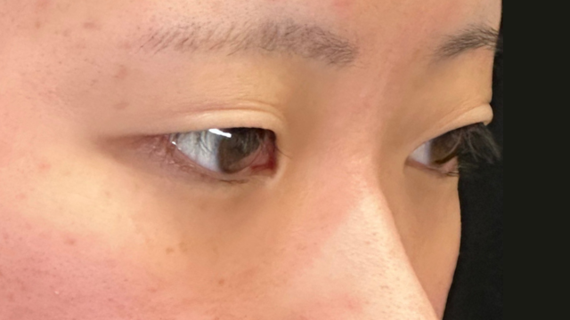 Postoperative Condition Part 1