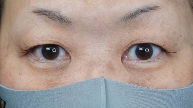 Postoperative Condition Part 1