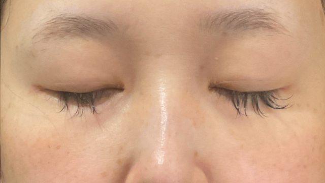 Postoperative Condition Part 1