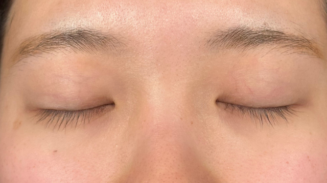 Postoperative Condition Part 1