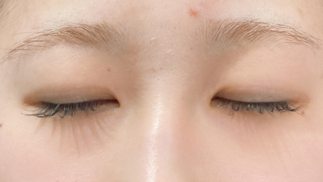 Postoperative Condition Part 1