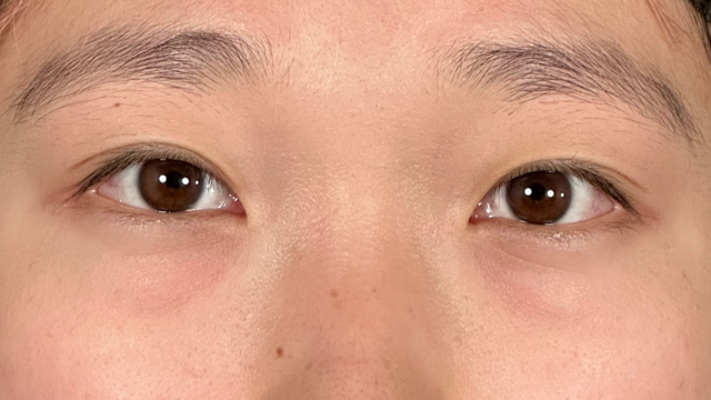 Postoperative Condition Part 1