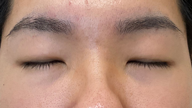 Postoperative Condition Part 1