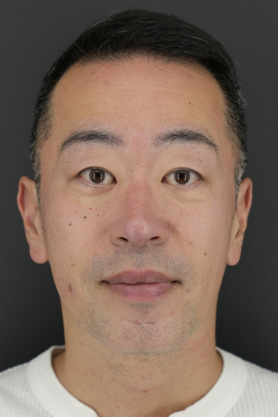 Postoperative Condition Part 1