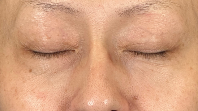 Postoperative Condition Part 1