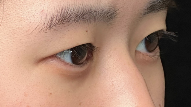 Postoperative Condition Part 1