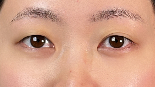 Postoperative Condition Part 1