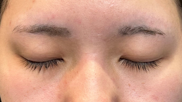 Postoperative Condition Part 1