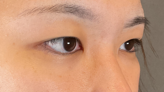 Postoperative Condition Part 1