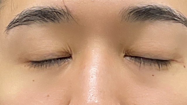 Postoperative Condition Part 1