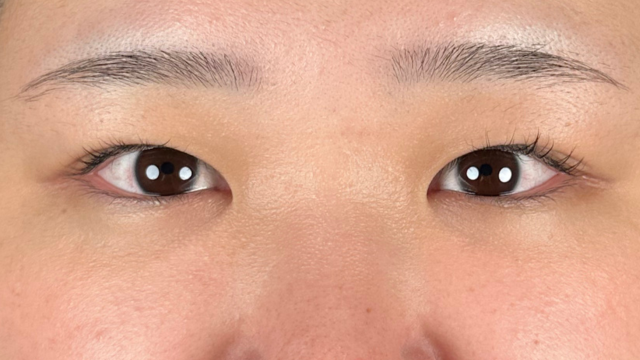 Postoperative Condition Part 1