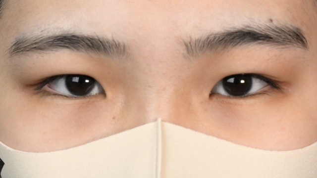 Postoperative Condition Part 1