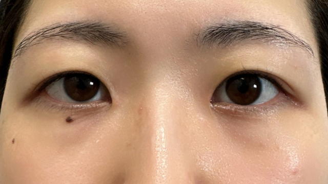 Postoperative Condition Part 1