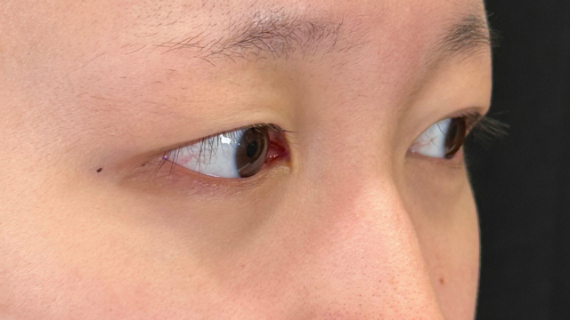 Postoperative Condition Part 1