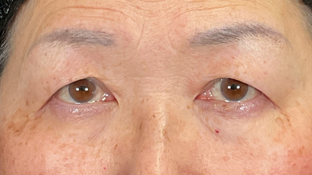 Postoperative Condition Part 1