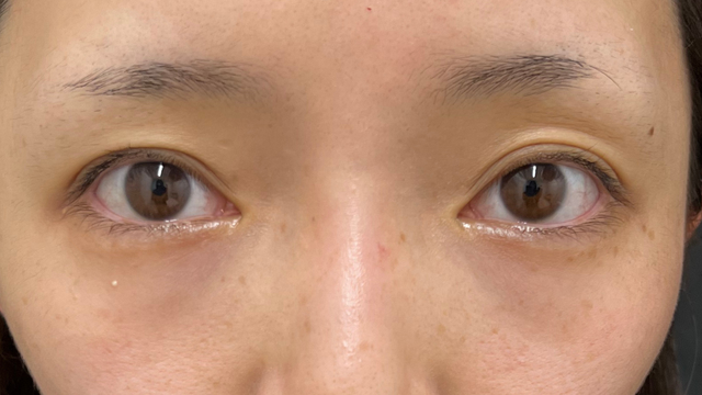 Postoperative Condition Part 1