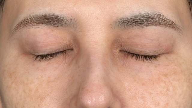 Postoperative Condition Part 1