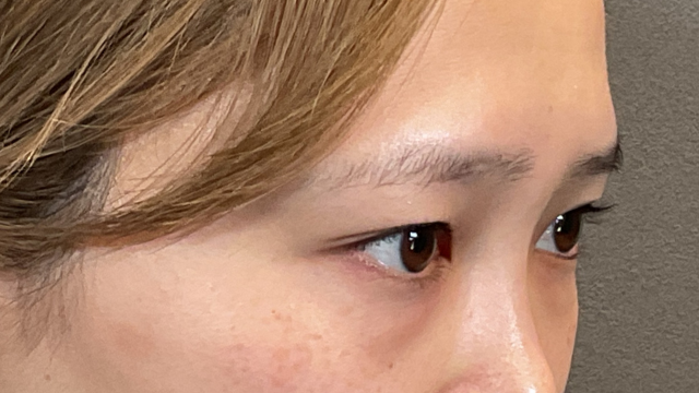 Postoperative Condition Part 1