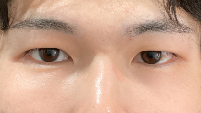 Postoperative Condition Part 1