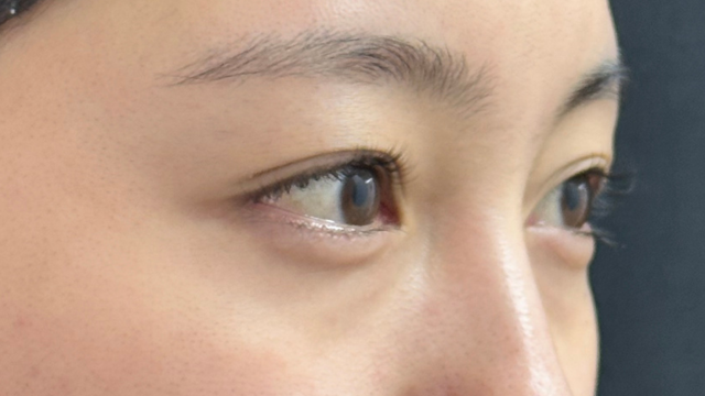 Postoperative Condition Part 1