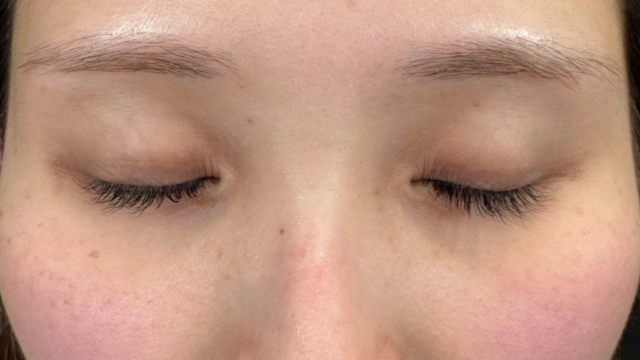 手术前的状态 其一