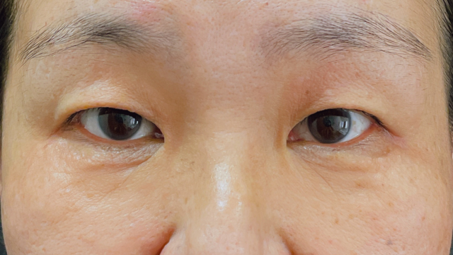 Postoperative Condition Part 1