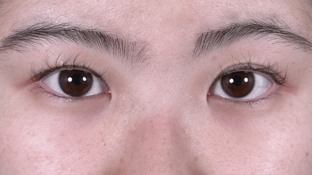 Postoperative Condition Part 1