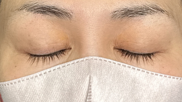 Postoperative Condition Part 1