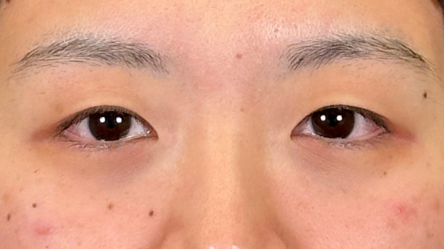 Postoperative Condition Part 1