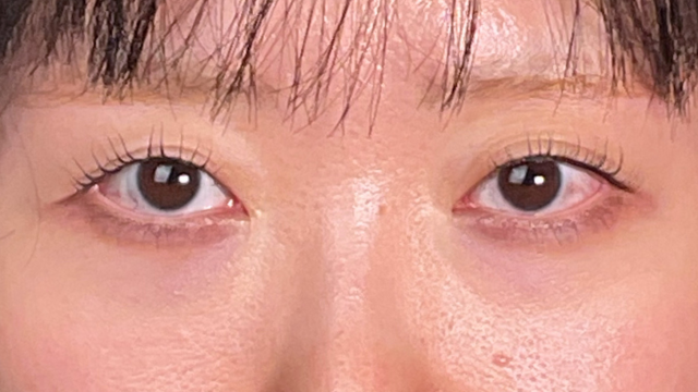 Postoperative Condition Part 1