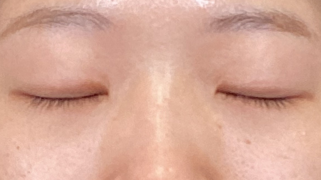 手术前的状态 其一