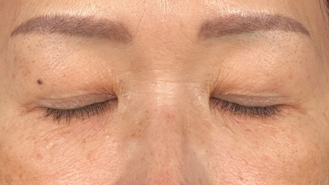 Postoperative Condition Part 1