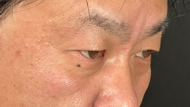 Postoperative Condition Part 1