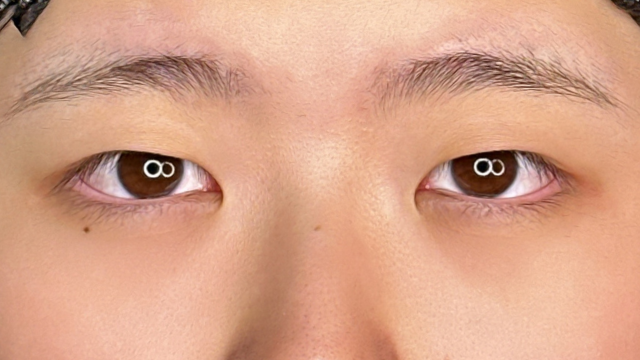 Postoperative Condition Part 1