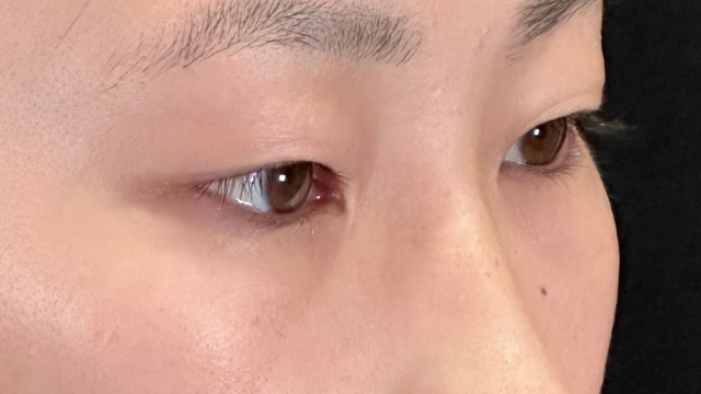 Postoperative Condition Part 1