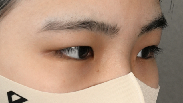 Postoperative Condition Part 1