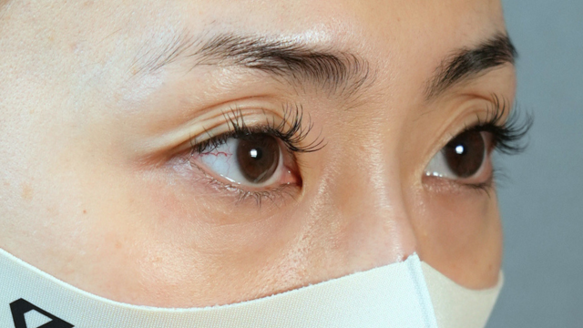 Postoperative Condition Part 1