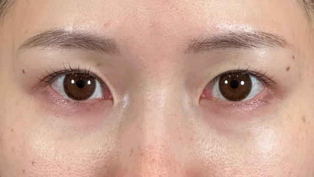 Postoperative Condition Part 1