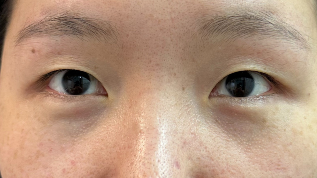 Postoperative Condition Part 1