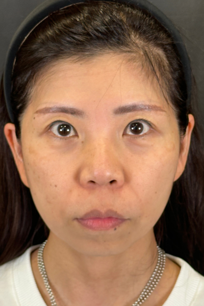 Postoperative Condition Part 1