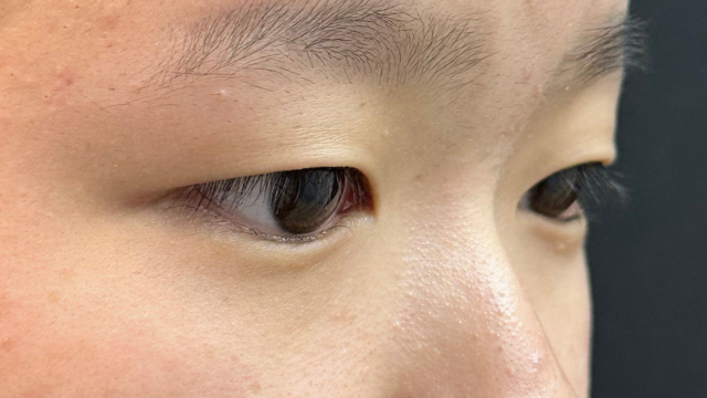 Postoperative Condition Part 1