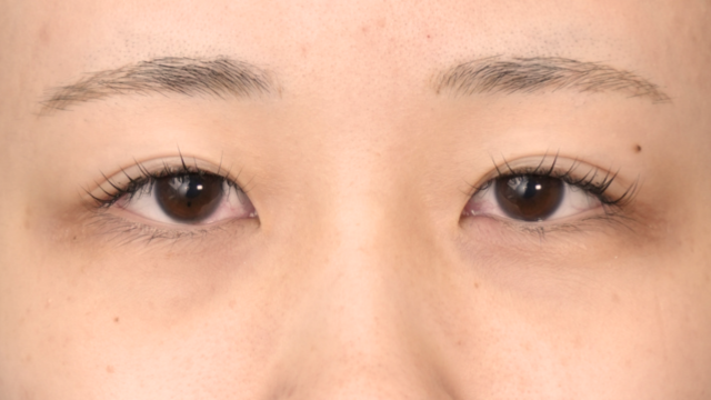 Postoperative Condition Part 1