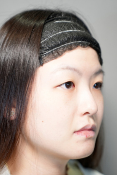 Postoperative Condition Part 1