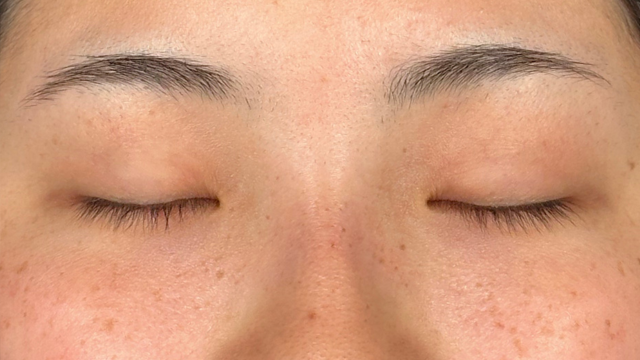 Postoperative Condition Part 1