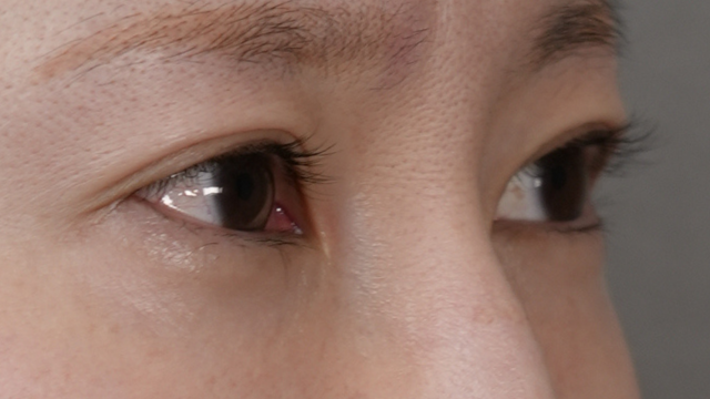 Postoperative Condition Part 1