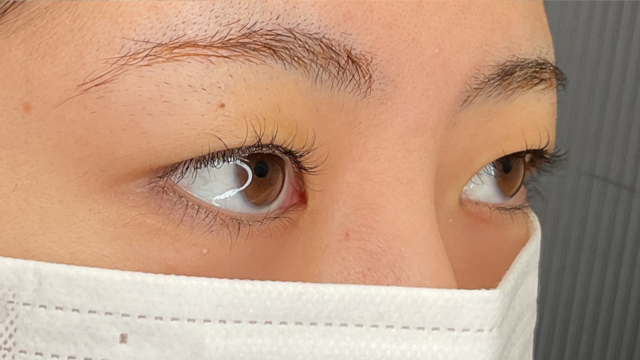 Postoperative Condition Part 1