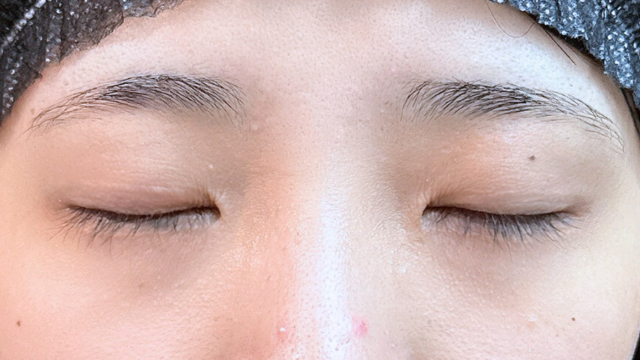 Postoperative Condition Part 1