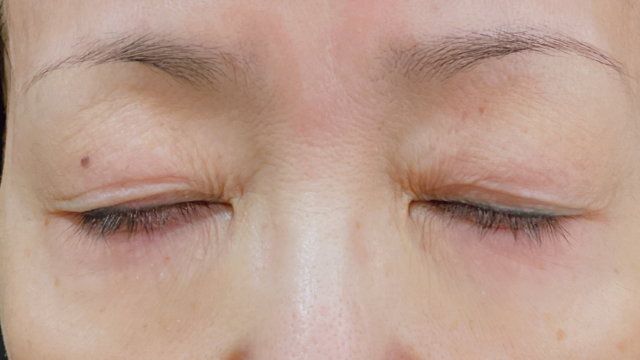 Postoperative Condition Part 1