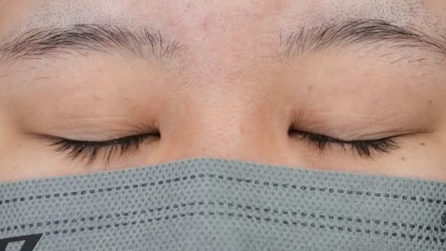 Postoperative Condition Part 1